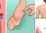 Waspadai 5 Tanda Gagal Ginjal yang Muncul di Kaki, Bisa Jadi Pertanda Serius